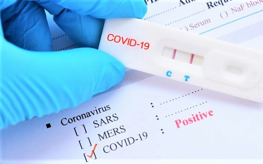 Các tỉnh, thành phố tăng cường thanh tra việc mua kit xét nghiệm Covid-19